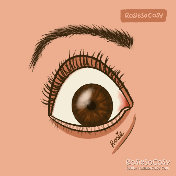 Illustration of a wide (brown) eye.